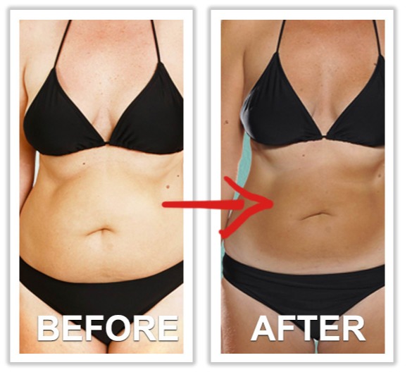 NitriLEAN weight loss supplement